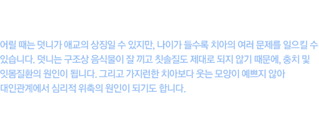 덧니란 치아가 올라올 공간이 부족해 제 위치에 올라오지 못한 상태를 말합니다. 치아의 적절하지 못한 배열위치는 심미적으로 악영향을 미침은 물론, 구강관리에 불리하게 작용하여 치주질환과 충치에 쉽게 이환되고 씹는 기능을 떨어뜨리게 됩니다. 무엇보다 치아가 고르지 않은 경우 웃을때 자연스럽지 않기 때문에 치료 이후 자신감 회복에도 큰 도움이 됩니다.